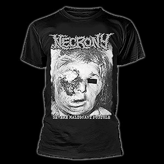 NECRONY - Severe Malignant Pustule T-SHIRT SIZE L