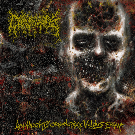 Cancrum Oris – Lymphadenitis Organopexic Vulnus Edema CD