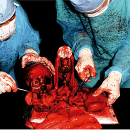 Miasmatic Necrosis – Apex Profane CD