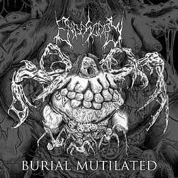 Endoscopy – Burial Mutilated MCD