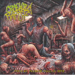 Cemetery Rapist – From My Puddled Phallic Drip CD