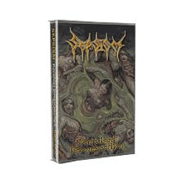 Sepsism – Purulent Decomposition TAPE