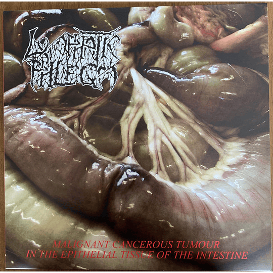 Lymphatic Phlegm / Flesh Grinder – Malignant Cancerous Tumour In The Epithelial Tissue Of The Intestine / From Rotten Process... To Anatomy LP