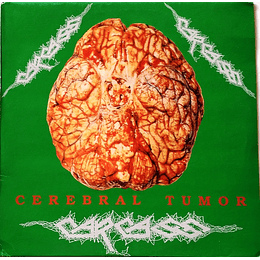 Carcass – Cerebral Tumor 2LPS