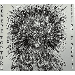 Severe Torture – Fisting The Sockets DIGMCD