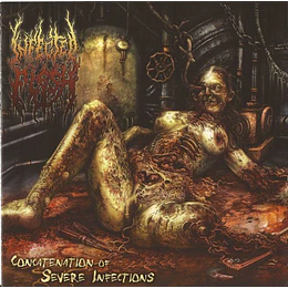 Infected Flesh – Concatenation Of Severe Infections CD