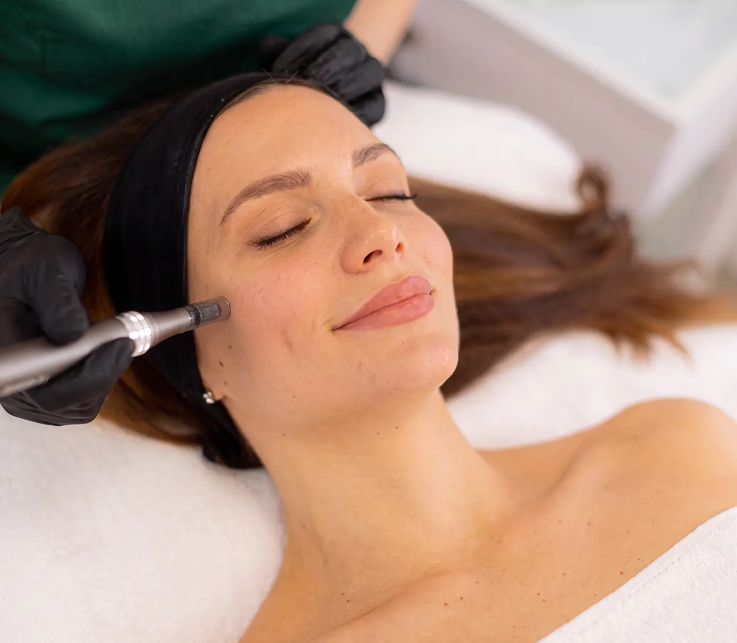 Pack Microneedling 1