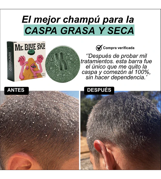 Shampoo en Barra - Anticaspa - Mr Blue Sky.