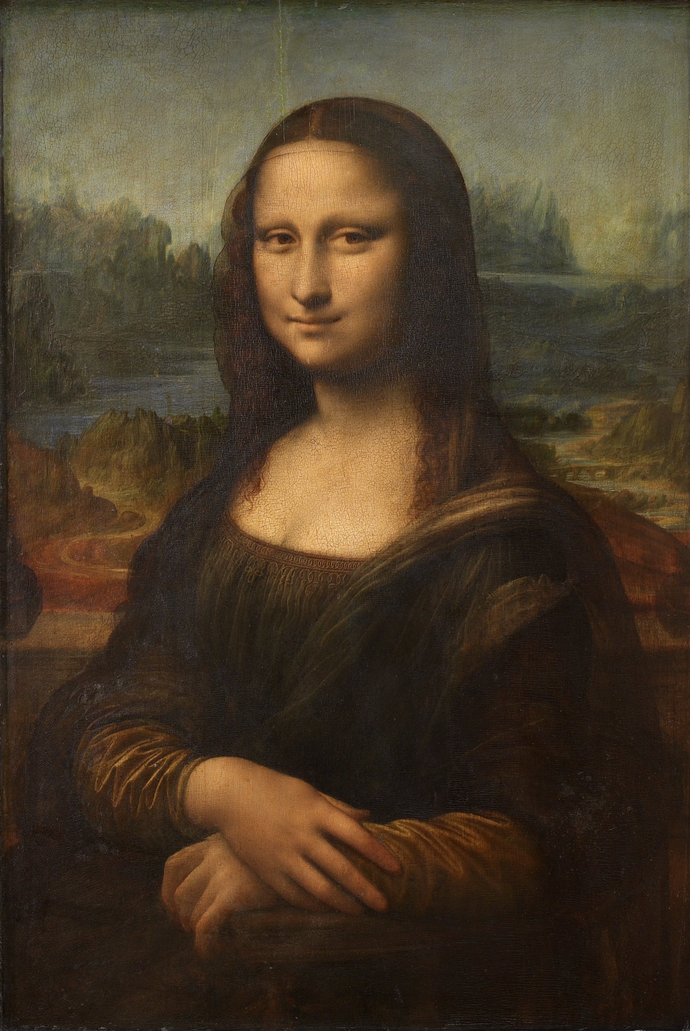 Vista frontal