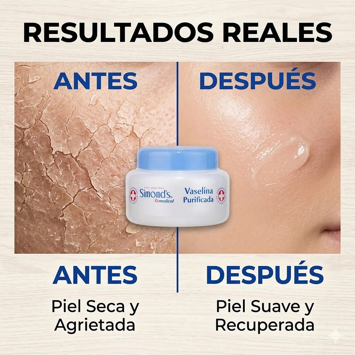 Vaselina Purificada Simonds Pote 110 Ml Protector Dérmico 3