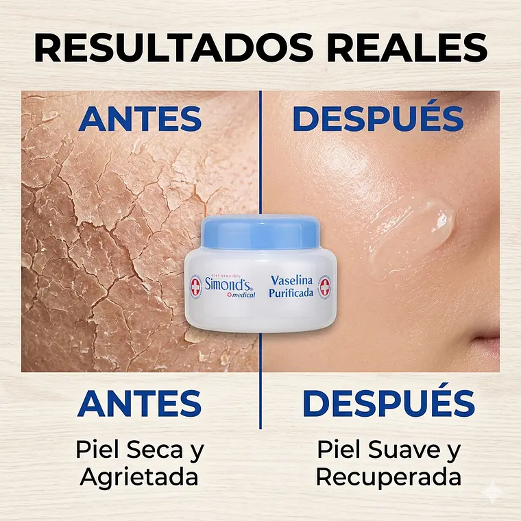 Vaselina Purificada Simonds Pote 110 Ml Protector Dérmico 3