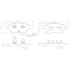Pastillas Freno Audi S8 2003-2010 Delantero 2