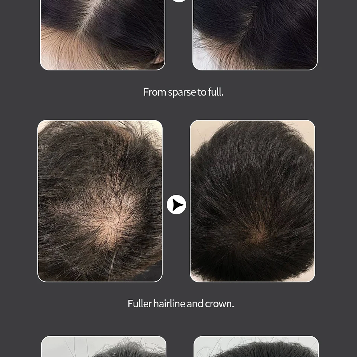 LEWEDO-polvo de fibra para el cabello, 25g, queratina, fibra para construcción del cabello, polvo para el crecimiento del cabello, polvo para peinar el cabello, producto para el crecimiento del cabel 17