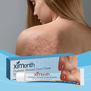 Ximonth Scar Care Cream for Gentle Body Moisturization Restores Redness and Discomfort