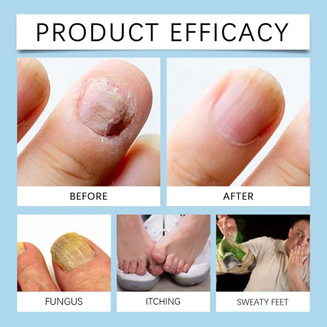 South Moon Nail Repair Essence  Nail Cleaning And Gentle Repair Cuticle Brightening Repair Lotion 5