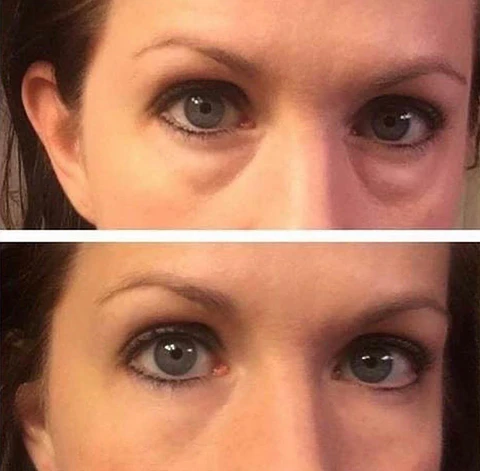 Kit Duo Antiojeras: Instant Eye Cream 5 Viales + Parches de Colágeno
