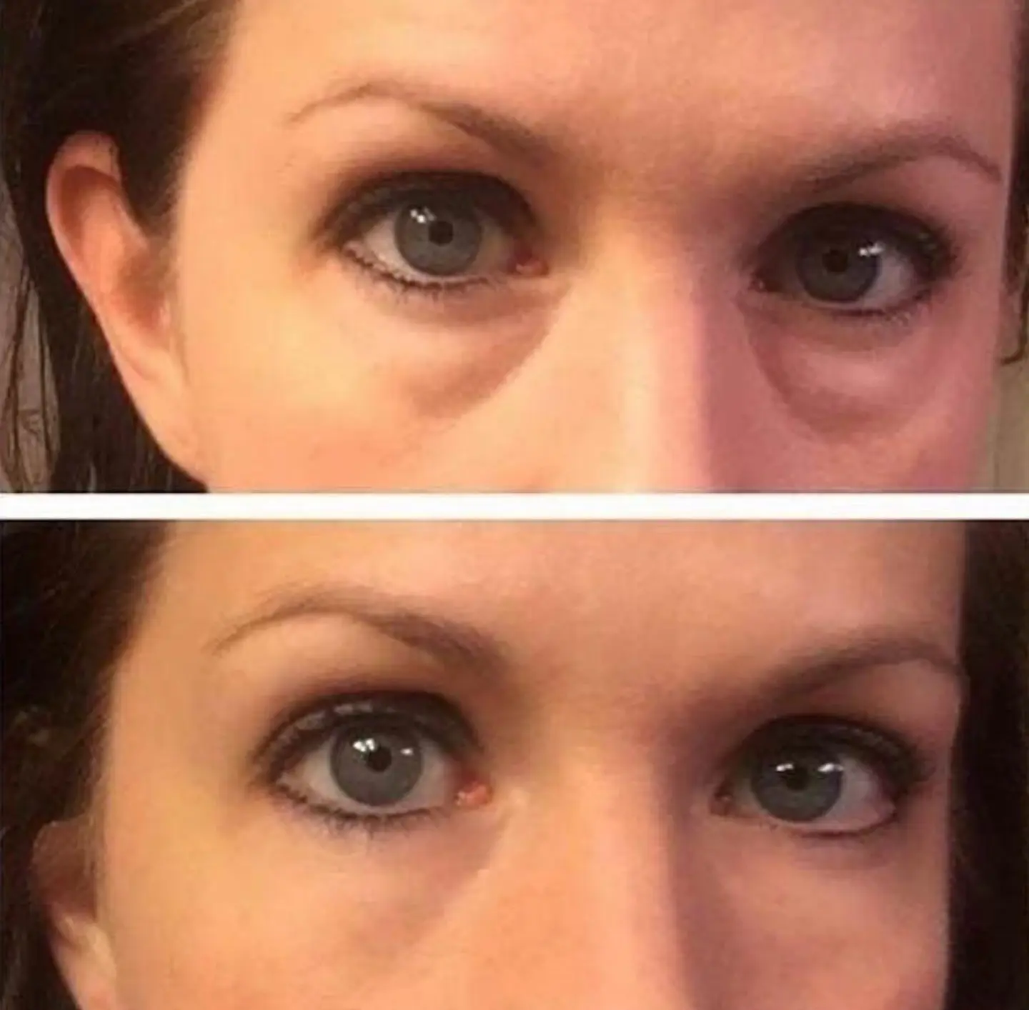 Kit Duo Antiojeras: Instant Eye Cream 5 Viales + Parches de Colágeno 2