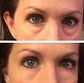 Kit Duo Antiojeras: Instant Eye Cream 5 Viales + Parches de Colágeno - Miniatura 2