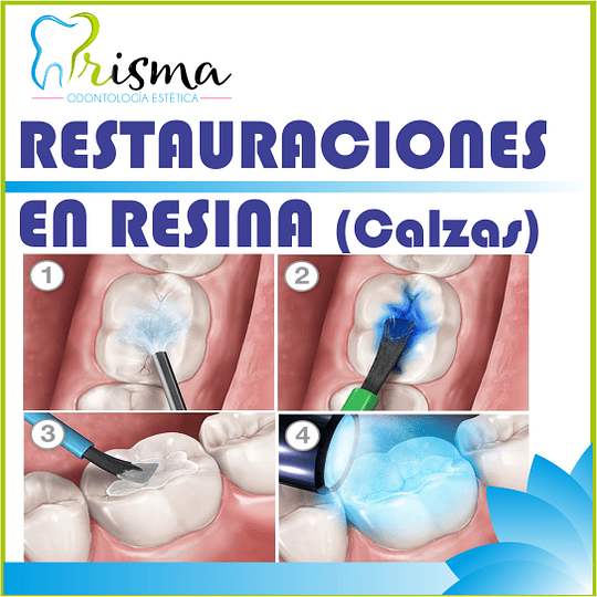 RESTAURACIONES EN RESINA desde $ 110.000