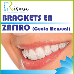 BRACKETS ZAFIRO ESTÉTICOS CUOTA MENSUAL