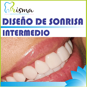 DISEÑO DE SONRISA INTERMEDIO