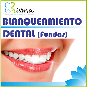 BLANQUEAMIENTO DENTAL CON FUNDAS