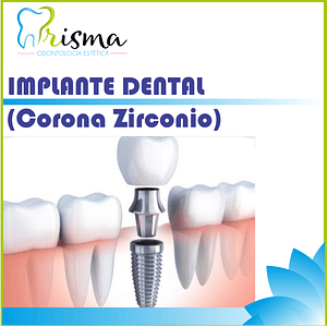 IMPLANTE DENTAL CON CORONA EN ZIRCONIO