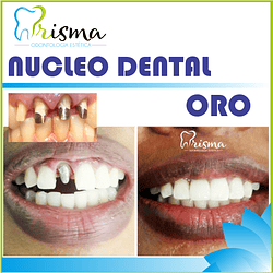 NÚCLEO DENTAL