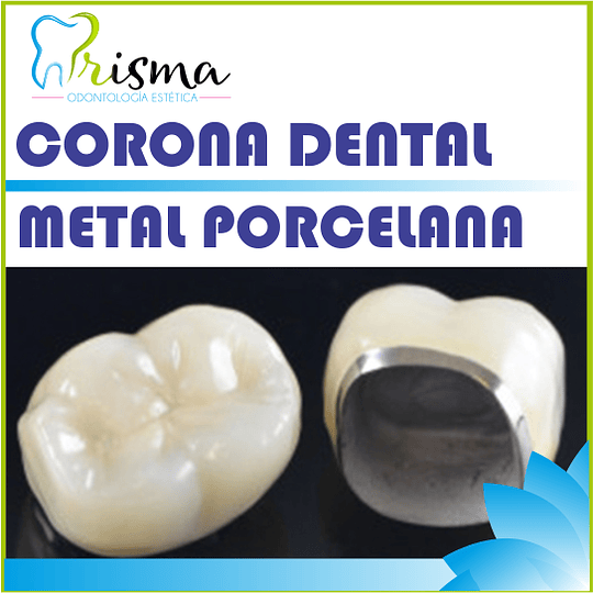 Coronas de Metal-Porcelana Barrio de Salamanca- Elysium Dental