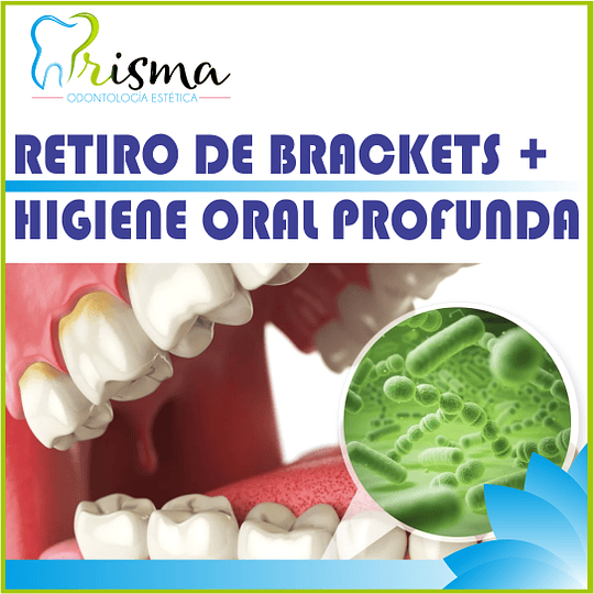 RETIRO DE BRACKETS + LIMPIEZA PROFUNDA