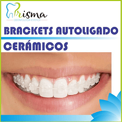 BRACKETS AUTOLIGADO CERÁMICOS CUOTA MENSUAL