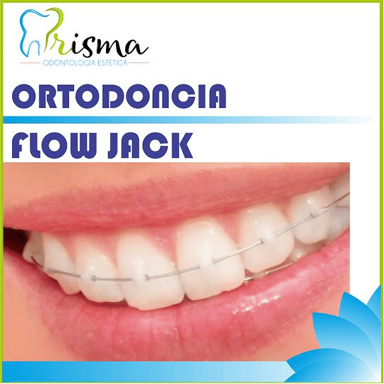 ORTODONCIA FLOW JACK SISTEM CUOTA INICIAL