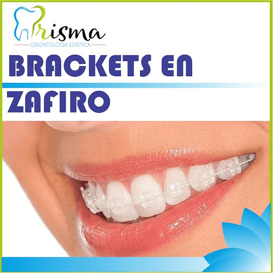 BRACKETS ZAFIRO ESTÉTICOS 