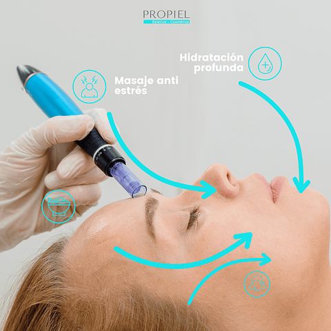 Microneedling + Vitaminas (Valor 3 sesiones)