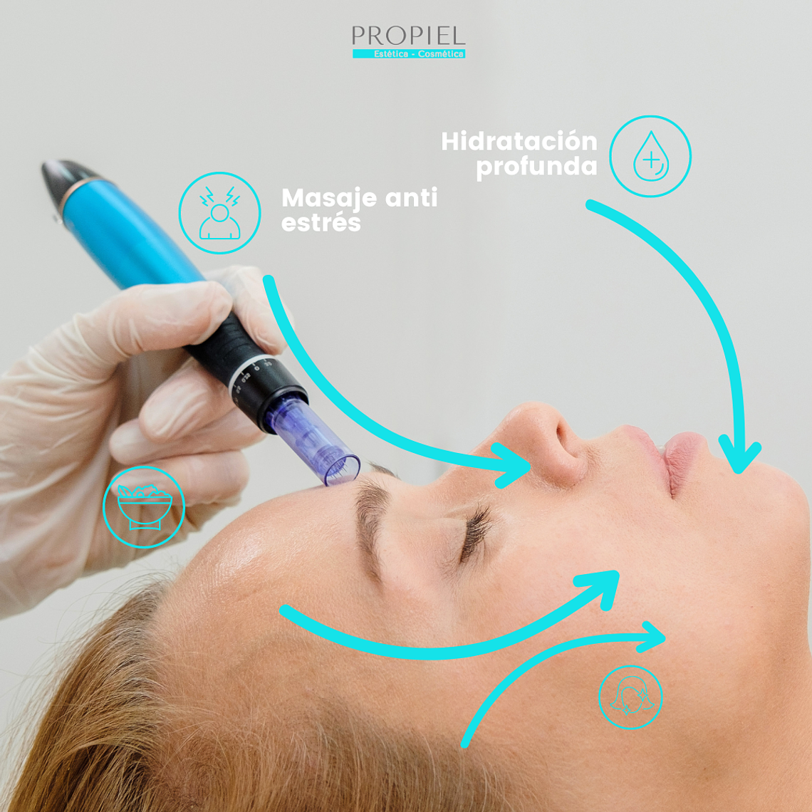 Microneedling + Vitaminas (Valor 3 sesiones) 1