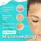 Limpieza Facial + Microneedling + Vitamina C - Miniatura 2