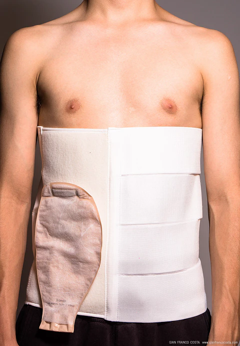 FAJA  DE COLOSTOMIA 4 BANDAS 