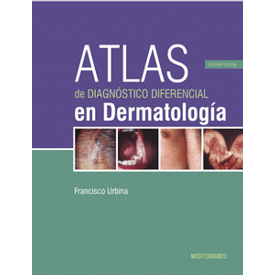 Atlas De Diagnostico Diferencial En Dermatologia 3º Edicion