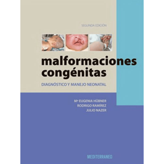 Malformaciones Congenitas 2º Edicion