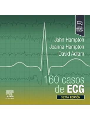 160 Casos De Ecg
