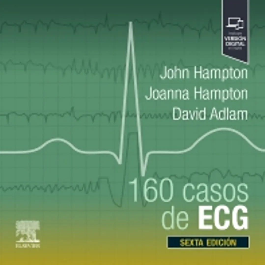 160 Casos De Ecg 1