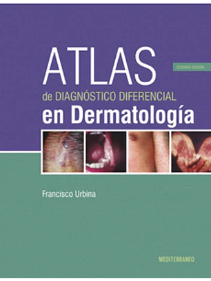 Atlas De Diagnostico Diferencial En Dermatologia 3º Edicion