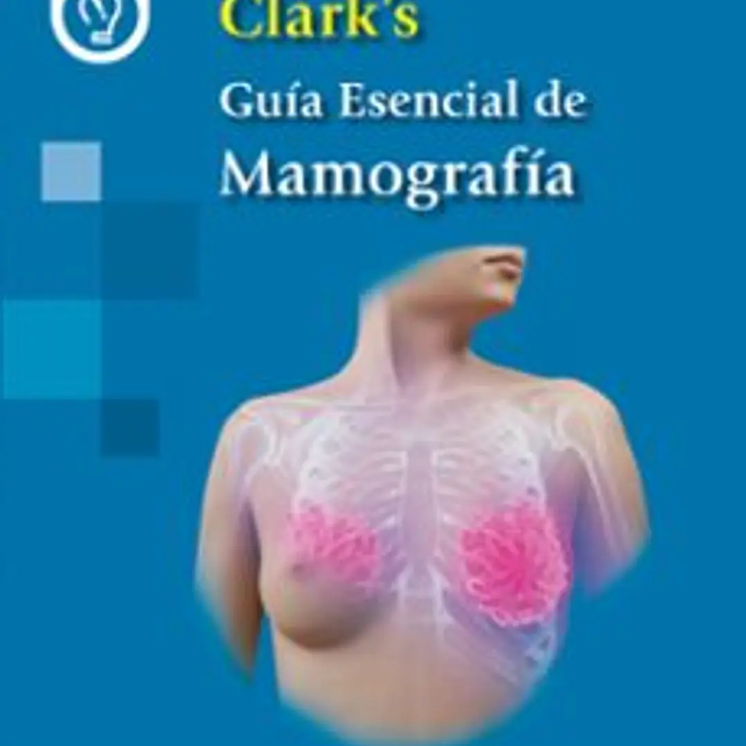 Clark's Guia Esencial De Mamografia 1