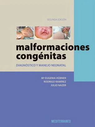 Malformaciones Congenitas 2º Edicion
