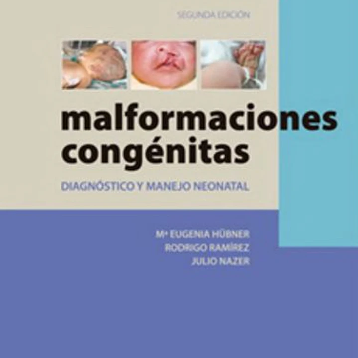 Malformaciones Congenitas 2º Edicion 1