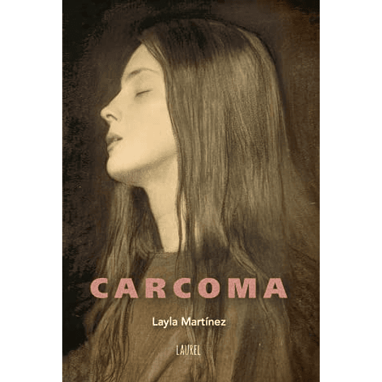 Carcoma