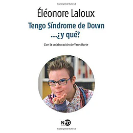 Tengo Sindrome De Down Y Que