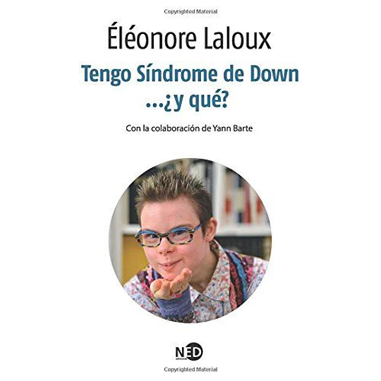 Tengo Sindrome De Down Y Que