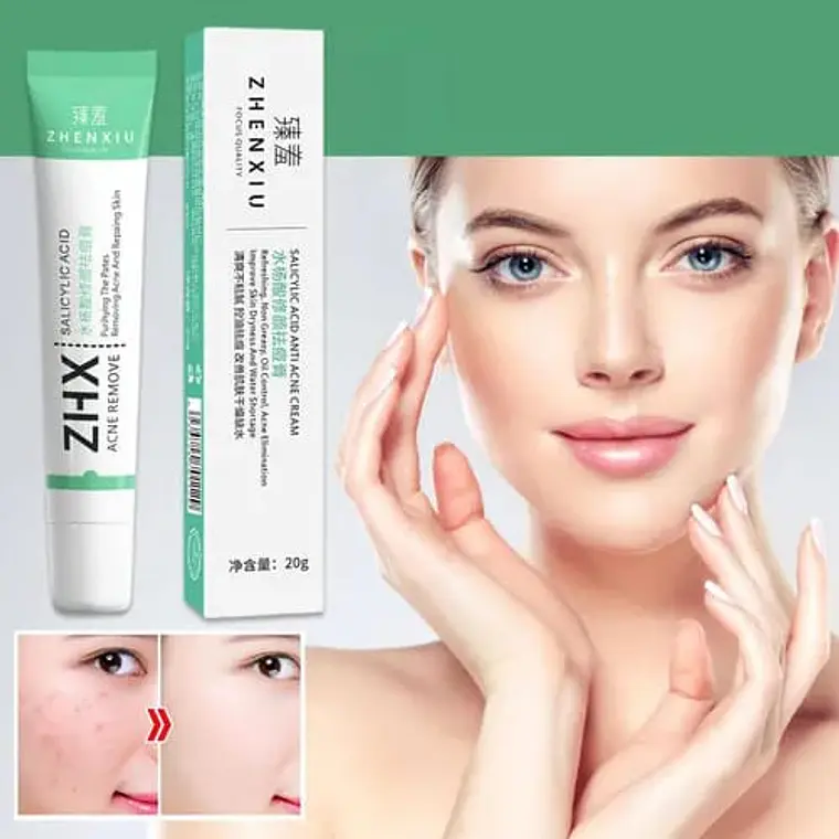 DUO DE GEL Y CREMA ANTI ACNÉ CAJITA VERDE Y ROJA 4