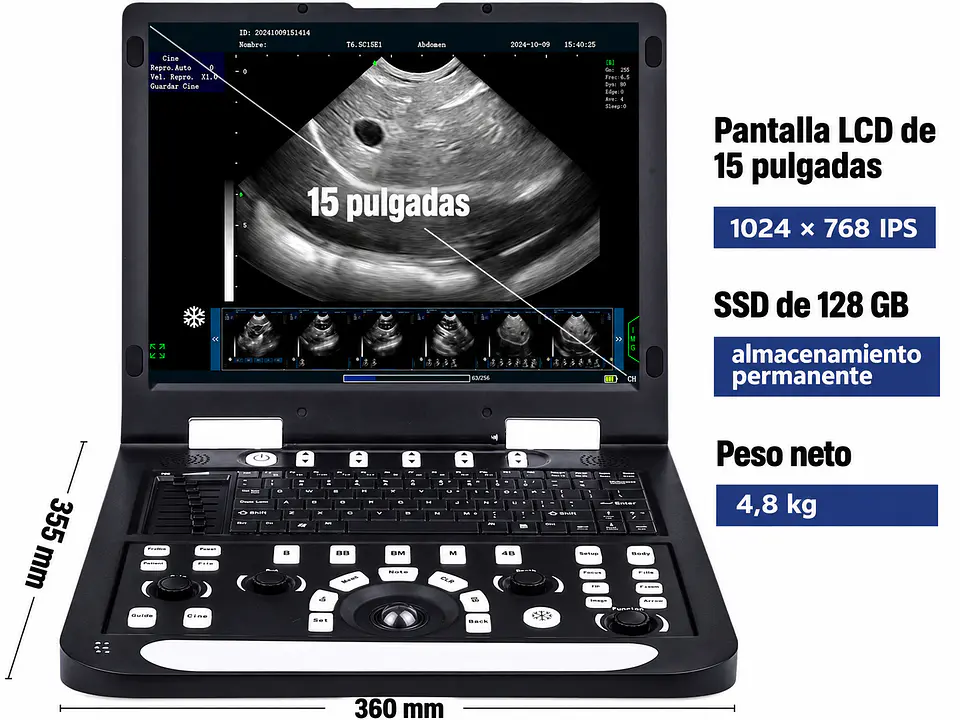 Ecografo Veterinario con transductor Macro convexo 2